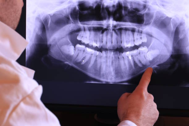 Best Broken or Cracked Tooth Emergency Dentist in Farm Loop, AK