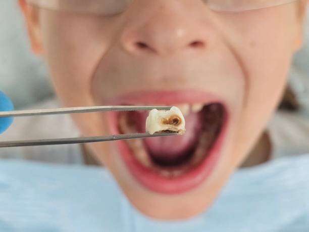 Best Urgent Dental Care for Toothache in Farm Loop, AK