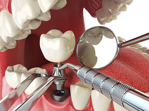 Best Emergency Root Canal Treatment in Farm Loop, AK