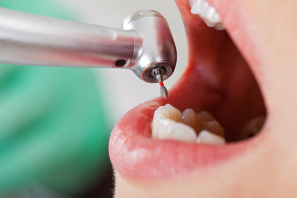 Professional Emergency Dentist in AK